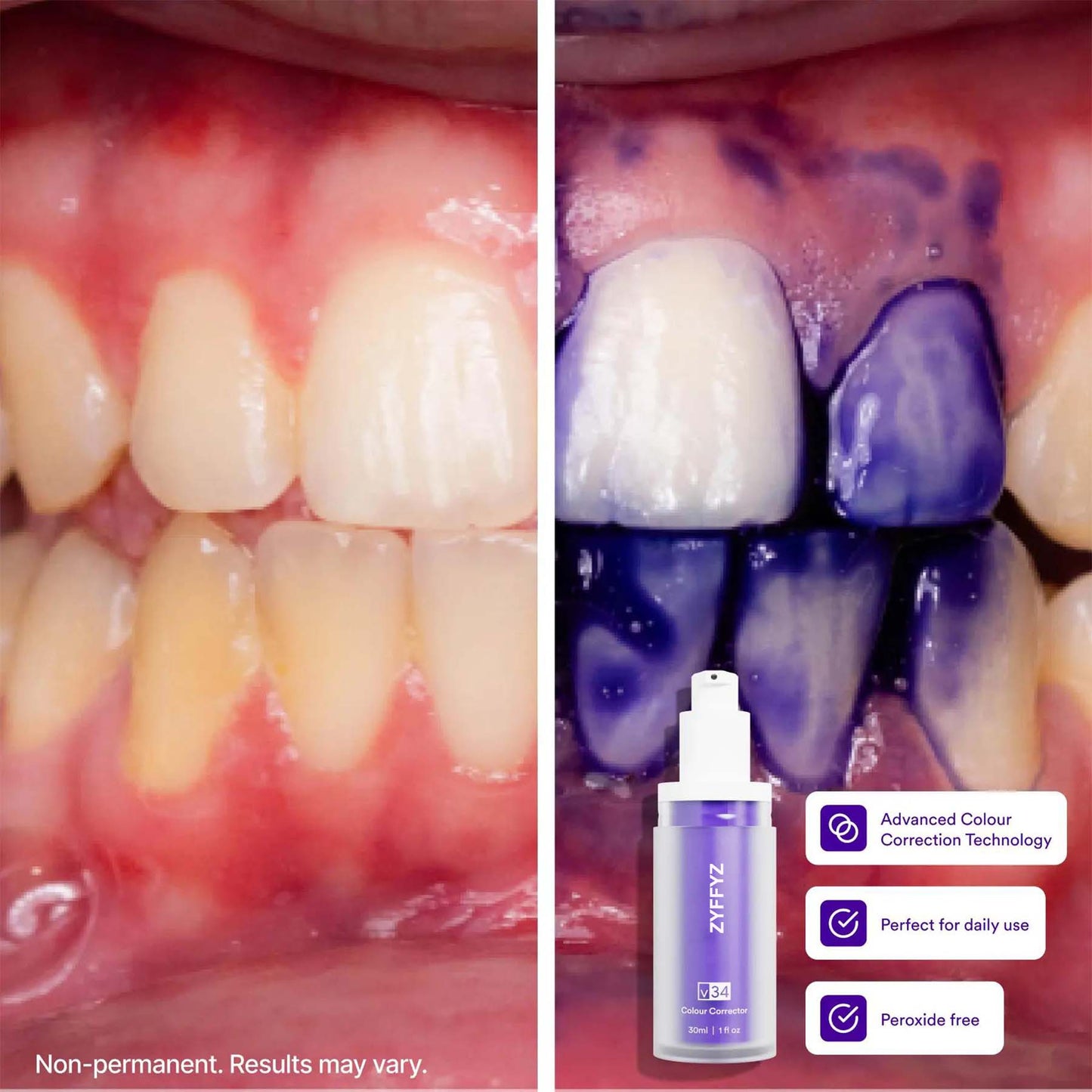 Tooth Stain Concealer, Temporary Brightening Booster, Purple Toothpaste, Colour Correcting