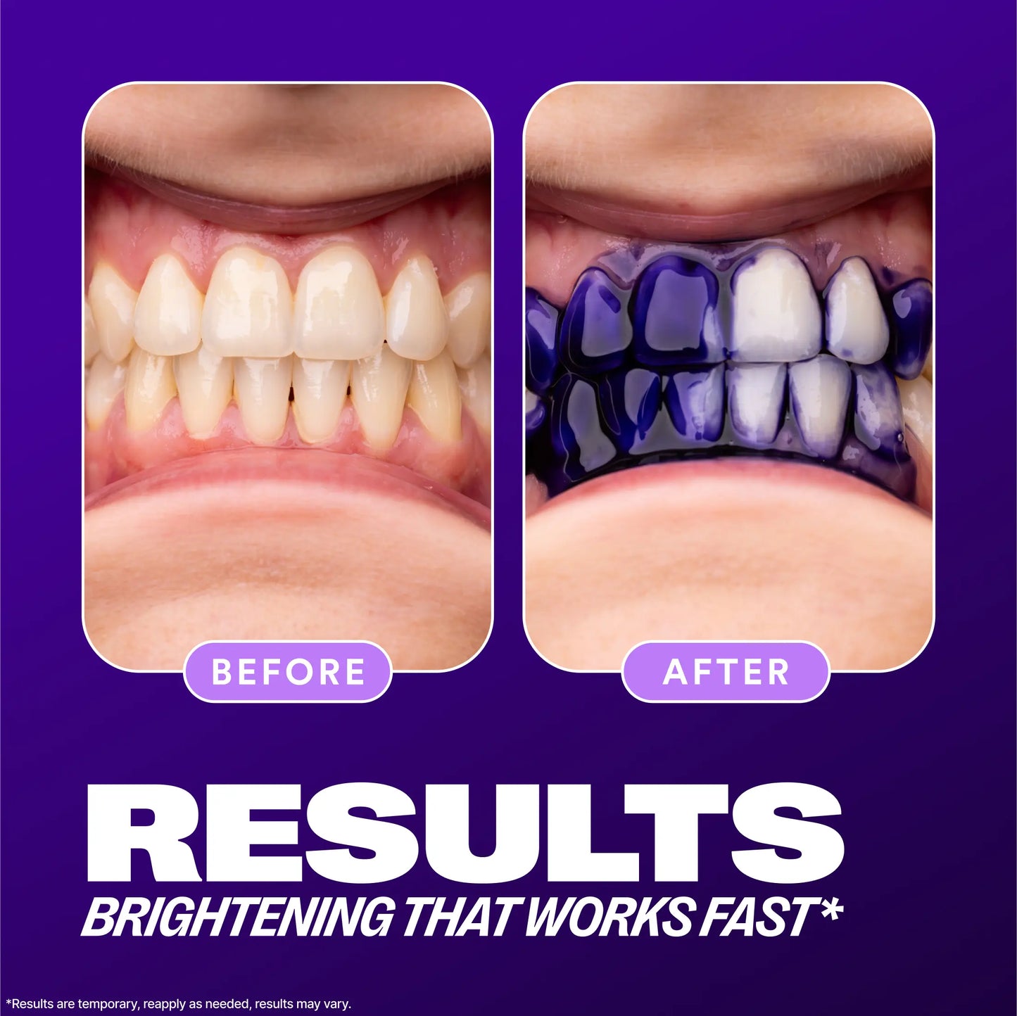 Tooth Stain Concealer, Temporary Brightening Booster, Purple Toothpaste, Colour Correcting