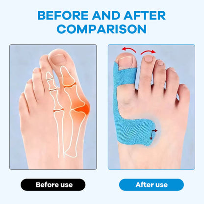 Pre-cut Bunion Corrector Kinesiology Tape